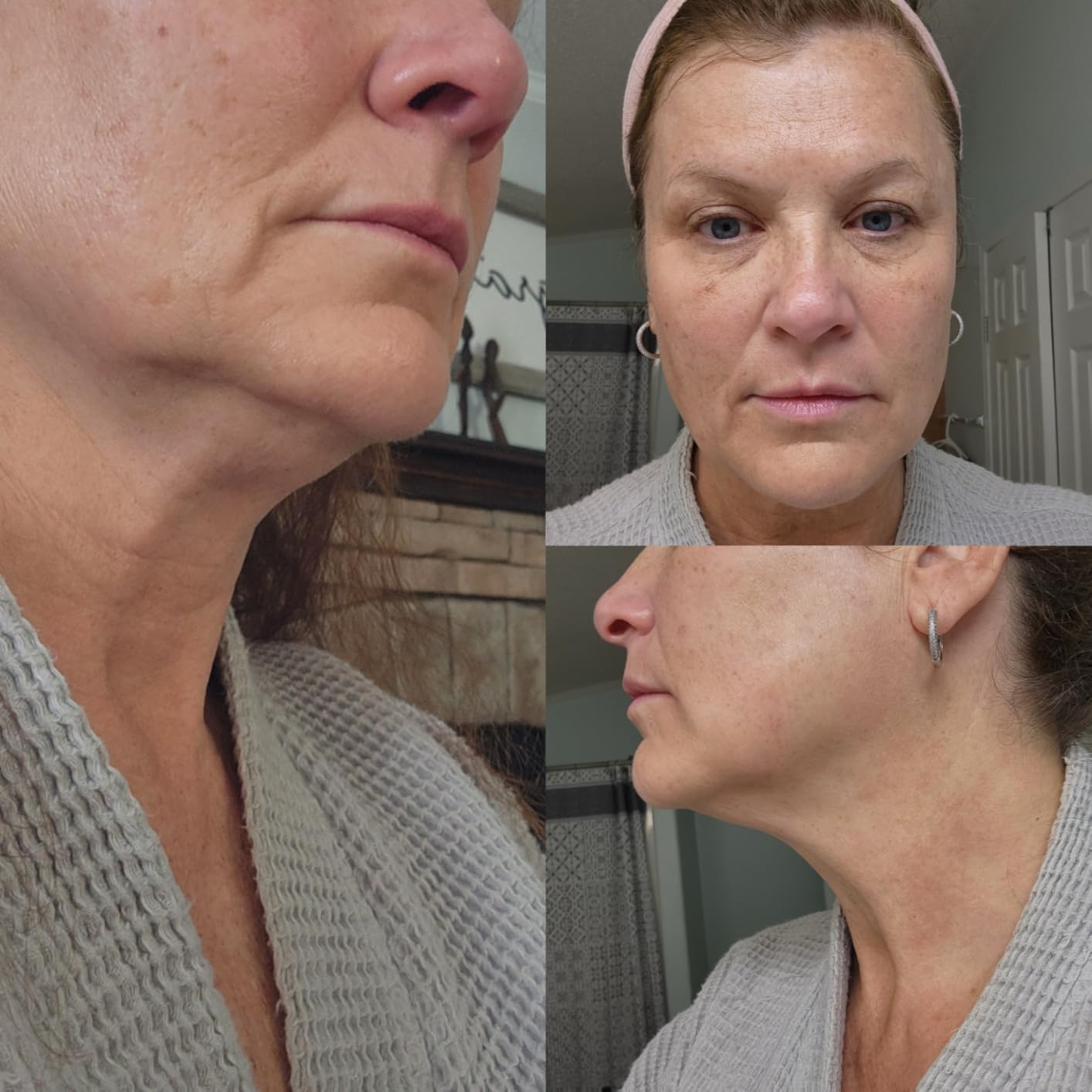 Firming Neck Cream and Roller Bundle