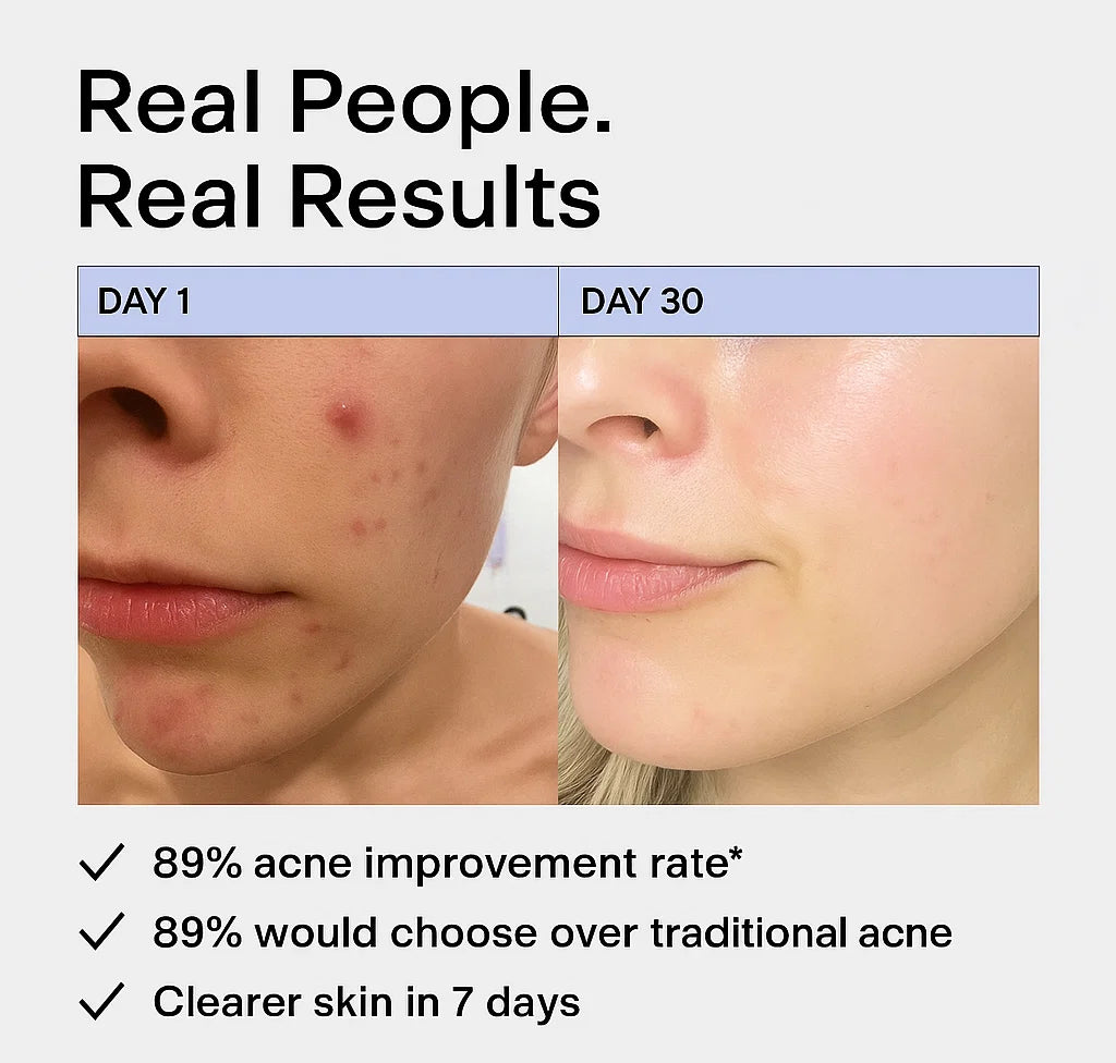 Hormonal Acne Supplement