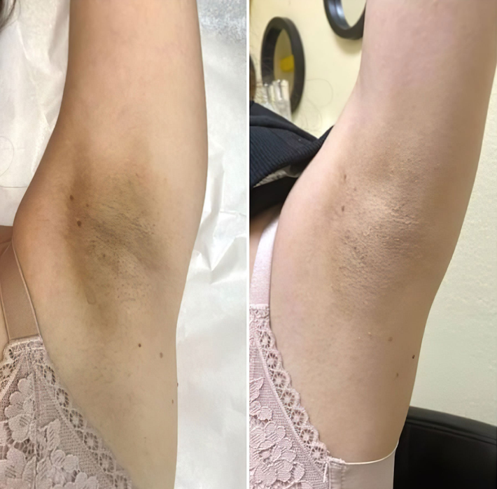 Peel Shot Glow Duo