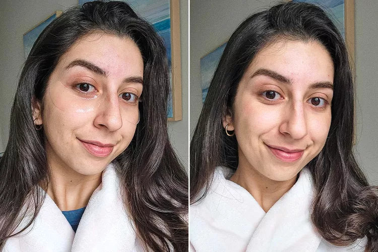 Collagen Eye Patches