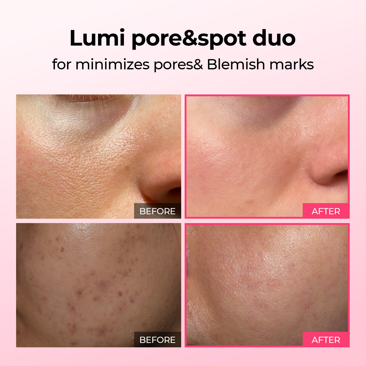 Pore & Spot Care Duo