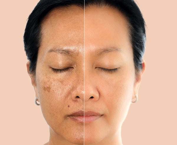 Pore & Spot Care Duo