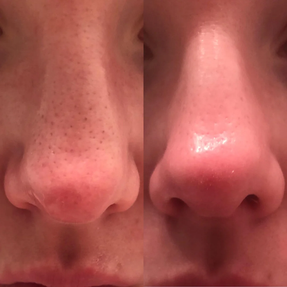 Peel Shot Glow Duo