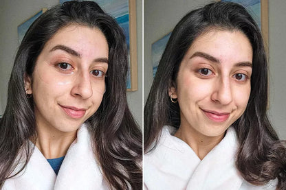 Collagen Eye Patches